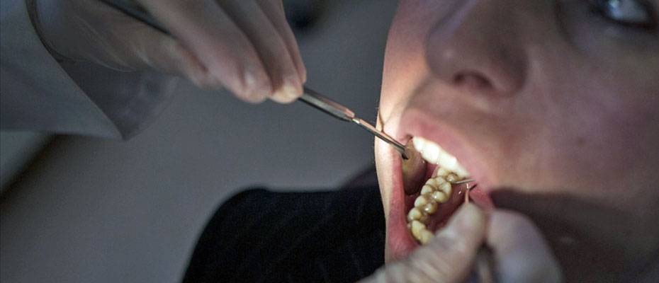 İspanyol diş hekimlerinden uyarı: Fas’taki ‘dental turizm’ patlaması endişe yaratıyor - Haberi Oku